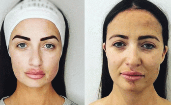 Latest News Chantelle Houghton Before And After
