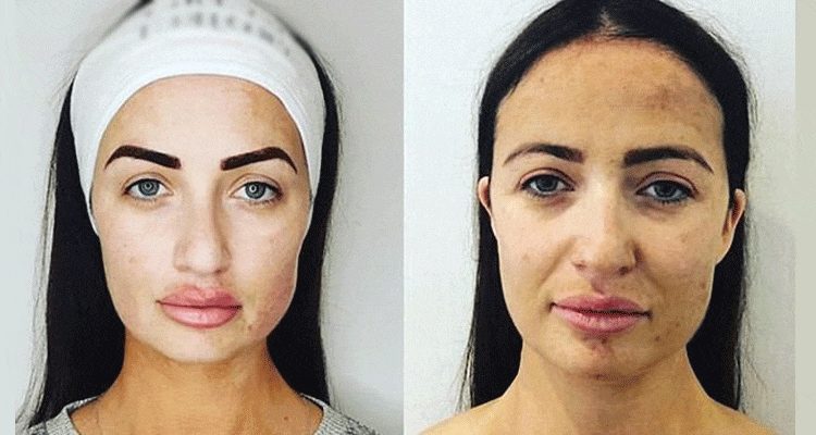 Latest News Chantelle Houghton Before And After
